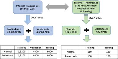 External validation based on transfer learning for diagnosing atelectasis using portable chest X-rays